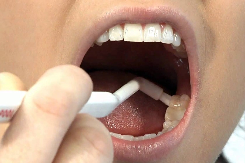 Монопучковая зубная щетка